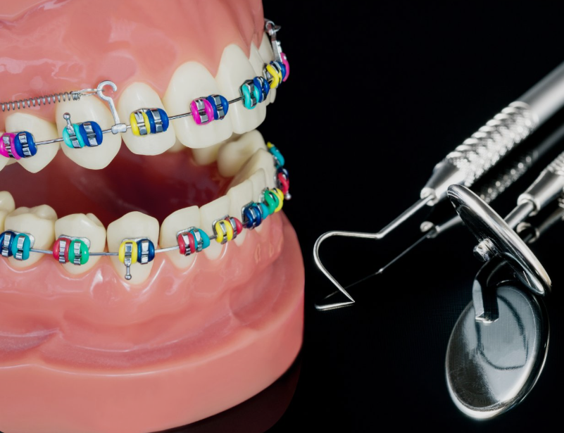 ortodoncia instrumental especifico clinica dental - Ortodoncia y bruxismo en la clínica dental: tipos de tratamiento, aparatología, materiales y papel del auxiliar 2026