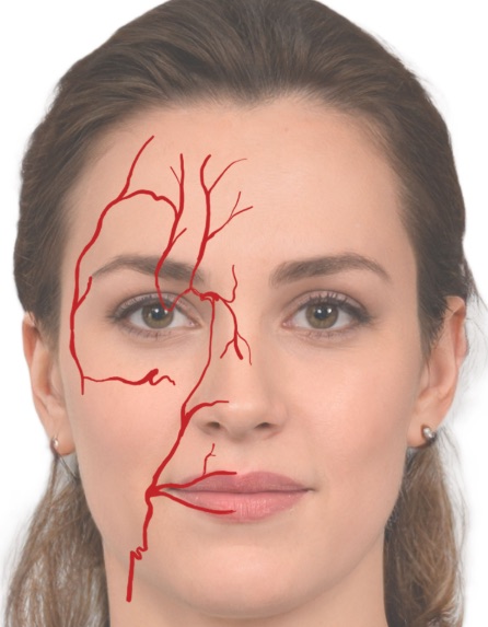 Facial contouring: anatomía, técnicas y límites de la remodelación facial 3 Rostro femenino con el recorrido de las arterias faciales trazado en rojo sobre media cara