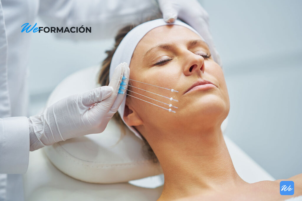 Colocación de hilos tensores en el rostro de una paciente en consulta