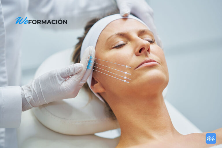 Colocación de hilos tensores en el rostro de una paciente en consulta