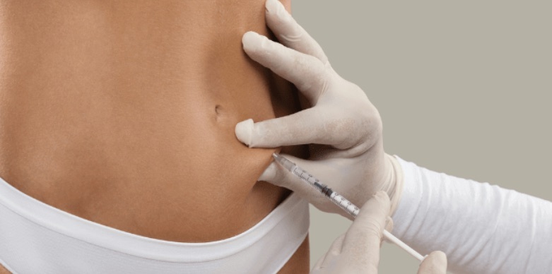 Mesoterapia en medicina estética: qué es, cómo funciona, productos y protocolo del auxiliar 2 Profesional infiltrando mesoterapia corporal en el abdomen de una paciente