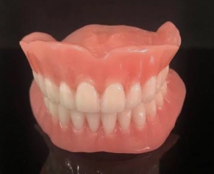 Prótesis dental en la clínica odontológica: tipos, materiales, cementado, CAD-CAM y papel del auxiliar 1 Prótesis dental completa removible de las arcadas superior e inferior