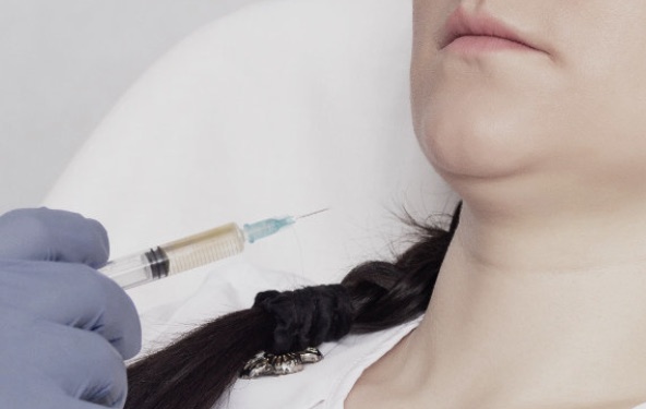 Inyecciones para eliminar la papada: qué es el ácido desoxicólico y qué advierte su nueva ficha técnica 1 Mano con guante inyectando con una jeringa bajo el mentón de una paciente recostada